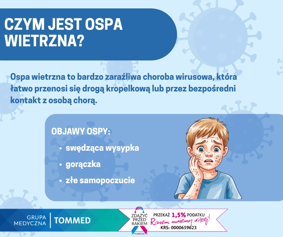 Czym jest Ospa? Szczeg&oacute;ły w treści