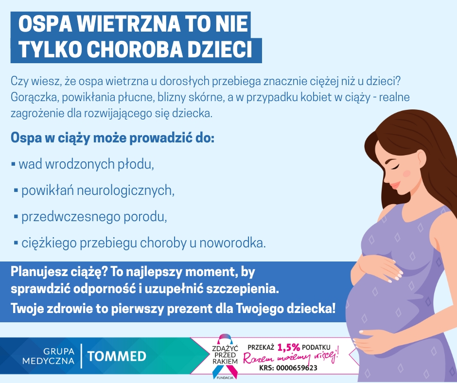 Ospa to nie tylko choroba dzieci. Szczeg&oacute;ły w treści.